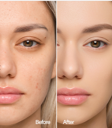 COUVRANCE LISSANTE + SPF 30 : LE SECRET D’UN TEINT ZÉRO DÉFAUT